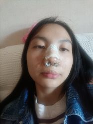 体验后-重庆联合丽格第五医疗美容医院