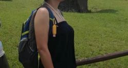 体验前-洁铭新加坡医美