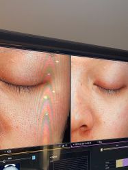 -苑苑vbeauty科技美容SPA