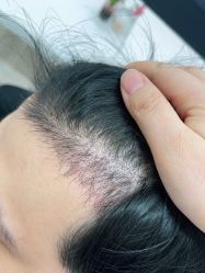 -雍禾植发全国连锁