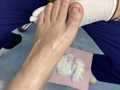 -Andrew指甲专科灰指甲·甲沟炎矫正·3D步态矫形鞋垫定制(上海法华镇路旗舰店)