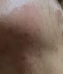 -菜菜美甲美睫皮肤管理