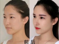 -上海时光整形外科医院