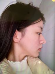 -长沙雅美医疗美容医院