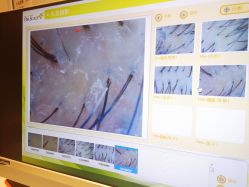 -LESSMORE科技头皮理容中心