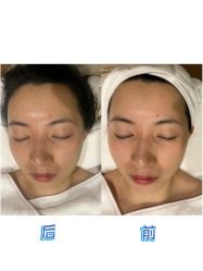 点击看大图 -半岛故事·法儿曼抗衰·indiba中心