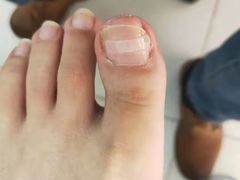 -新甲连锁灰指甲·甲沟炎·鸡眼(黑龙江路店)