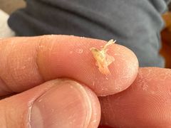 -郑远元专业修脚房·按摩·肉刺·灰指甲(郭新东路店)