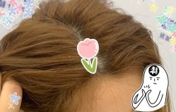 -大麦微针植发全国连锁