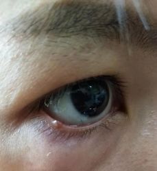 -北京美痣堂古方祛痣斑疣瘊