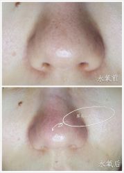 水氧-光SPA科技美肤