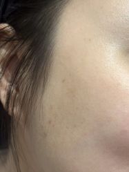 点击看大图 体验前-广州美莱医疗美容医院