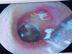 -溥耳·可视采耳·头疗·沐眼