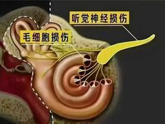 -自然之声助听器(平凉店)