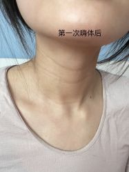 点击看大图 -小忠丽格医美