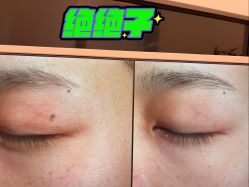 -苑苑vbeauty科技美容SPA