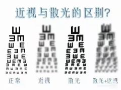 -宝岛眼镜·蔡司·依视路·青少儿近视防控验配中心(西市城购物中心店)