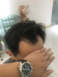 -发饰美男士增发补发假发定制店