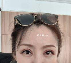 体验后-上海时光整形外科医院
