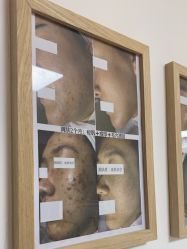 -美肤盾祛痘·问题肌头疗管理中心