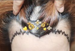 -大麦微针植发全国连锁