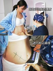 点击看大图 -深圳美莱医疗美容医院