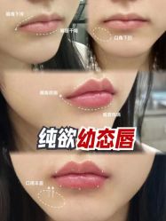 -上海伊莱美医疗美容医院