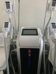 -肥三针腧穴瘦身馆