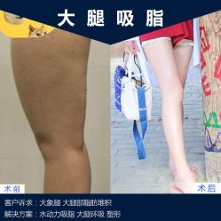 -北京丽星翼美医疗美容
