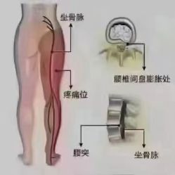 -香薇妮丝女子减肥院