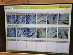 -LESSMORE科技头皮理容中心