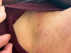 -杭州市第三人民医院