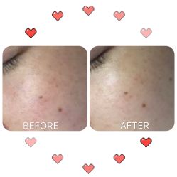 -MJ skin care国际皮肤管理中心