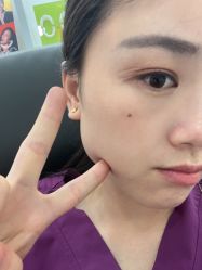 体验后-广州美莱医疗美容医院