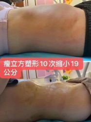 -瘦立方身材管理中心