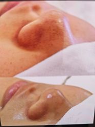 -SKIN79皮肤管理中心