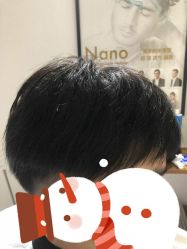 -髻尚坊增发补发织发假发定制