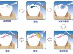-团圆口腔·种植中心(锦江院区)