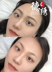 -德绣·机器野生眉发际线·美瞳线半永久