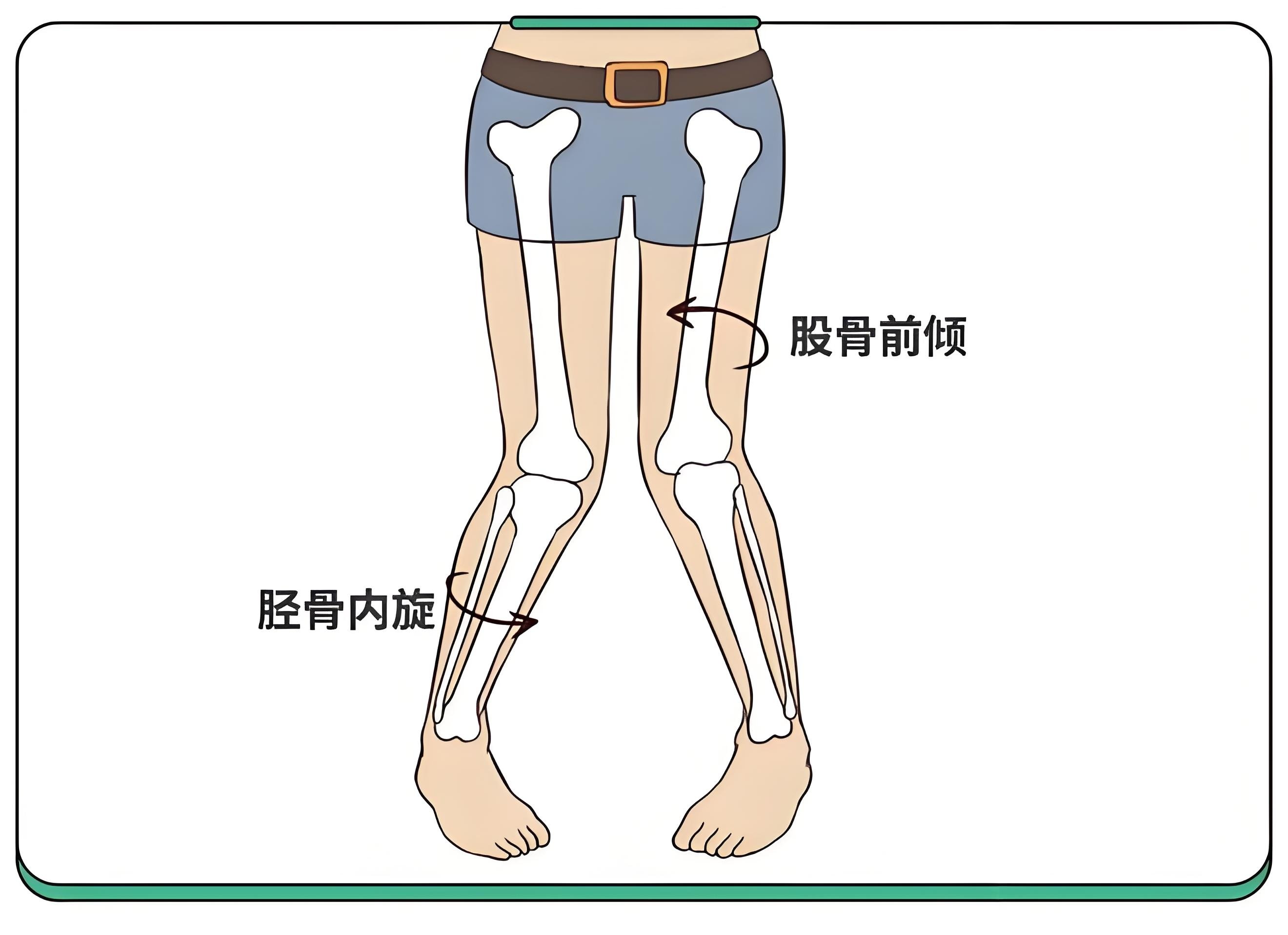 腿内旋外旋动作图图片