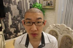 -大麦微针植发丨全国连锁