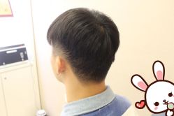 点击看大图 -大麦微针植发丨全国连锁