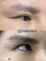 -北京丽星翼美医疗美容
