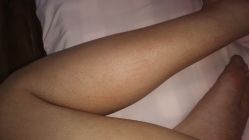 -禾美嘉医疗美容