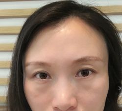 -八大处整形