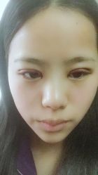 点击看大图 -成都西区医院整形美容