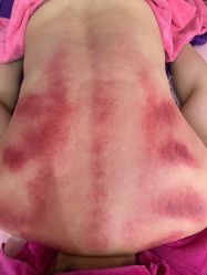 点击看大图 -云珍爱产后修复中心(尚格店)