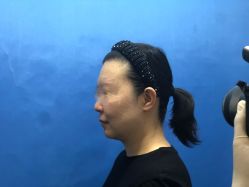 -八大处整形