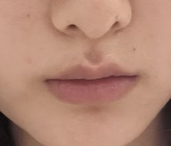 -Yestar艺星整形美容医院