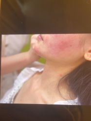 体验后-Yestar 嘉兴艺星医疗美容医院